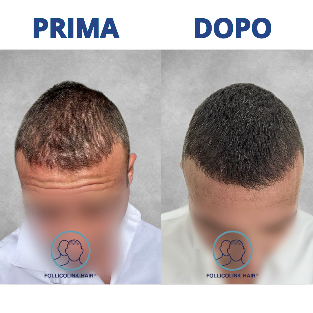 Effetto densità